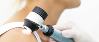 Melanoma, +30% di diagnosi nel 2024 ma cresce l'immunoterapia