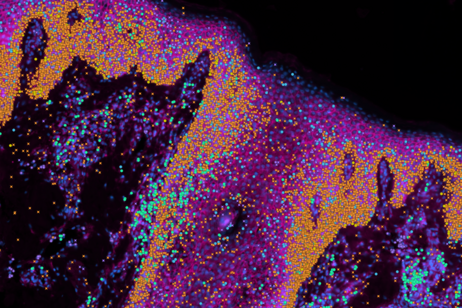 Ingrandimento di tessuto epiteliale (fonte:&nbsp;Wellcome Sanger Institute)