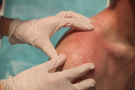 Visita dermatologica. Attestazione:Ivan-balvan - iStock