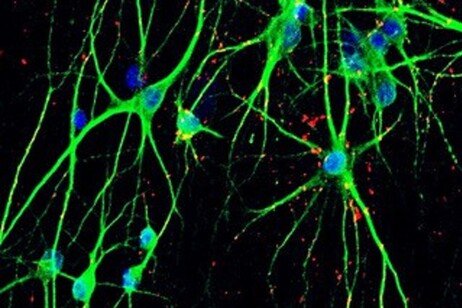 Un archivio di cellule per studiare le basi genetiche dei disturbi psichiatrici (fonte: MiNND group)