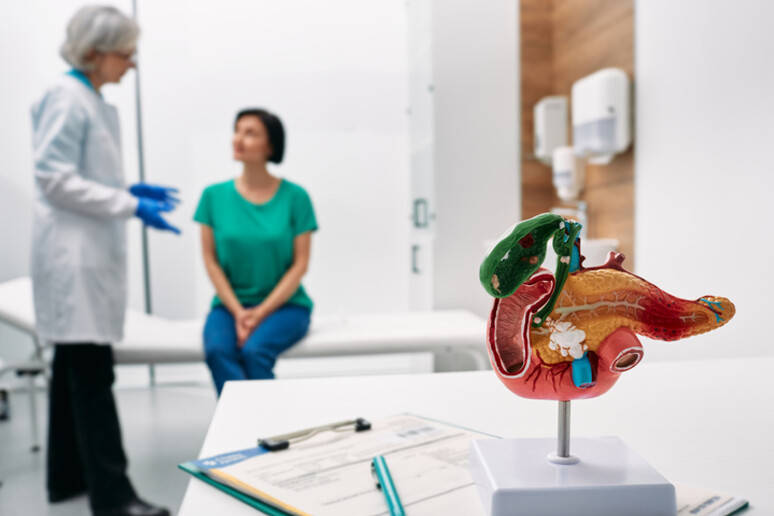 Gastroenterology consultation. Anatomical model of pancreas on doctor table over background gastroenterologist consulting woman patient with gastrointestinal disorders - RIPRODUZIONE RISERVATA