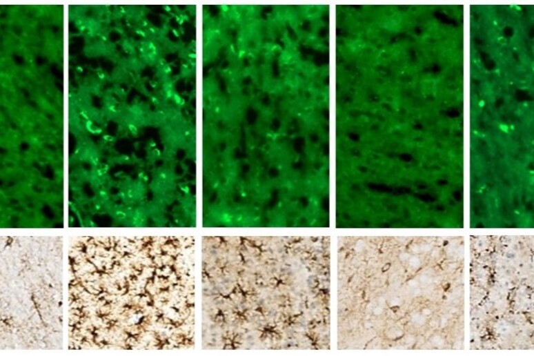 Aggregazione della proteina amiloide e neuroinfiammazione in una sezione di cervello di topo (fonte:  Fraldi/CEINGE) - RIPRODUZIONE RISERVATA