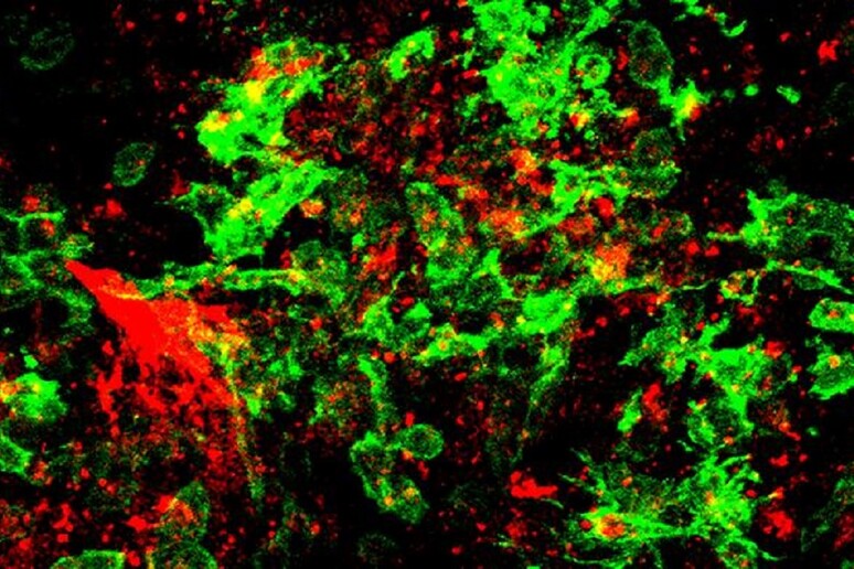 In rosso la fibrina e in verde la microglia nel cervello di un topo infettato da Covid-19 (fonte: Jae Kyu Ryu e Katerina Akassoglou, Gladstone Institutes) - RIPRODUZIONE RISERVATA