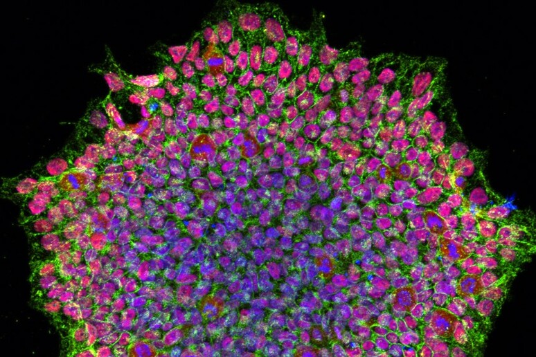 Colonia di cellule staminali pluripotenti indotte (Ipsc) dell 'occhio umano (fonte: National Eye Institute/NIH da Wikimedia) - RIPRODUZIONE RISERVATA